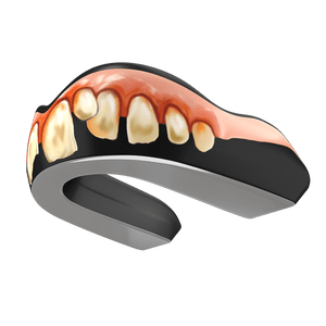Bubba Guard (EI) - Damage Control Mouthguards