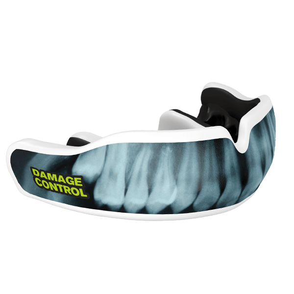X-Ray Custom Mouthguard - Damage Control Mouthguards