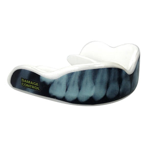 X-Ray Mouthguard (EI) - Damage Control Mouthguards