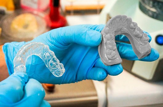 3D Printed mouth guards