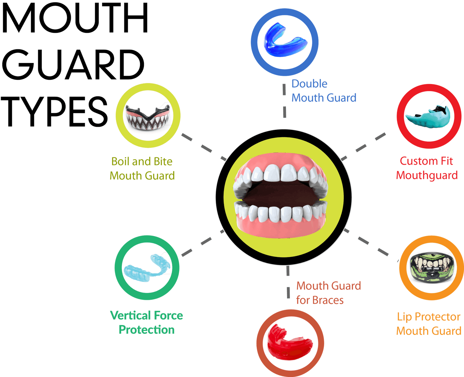 Types of mouthguards infographic