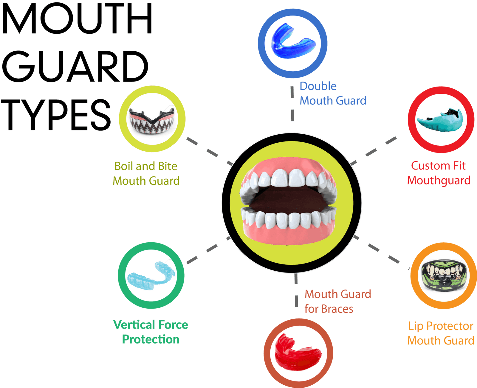 Types of Mouth Guards - Damage Control Mouthguards