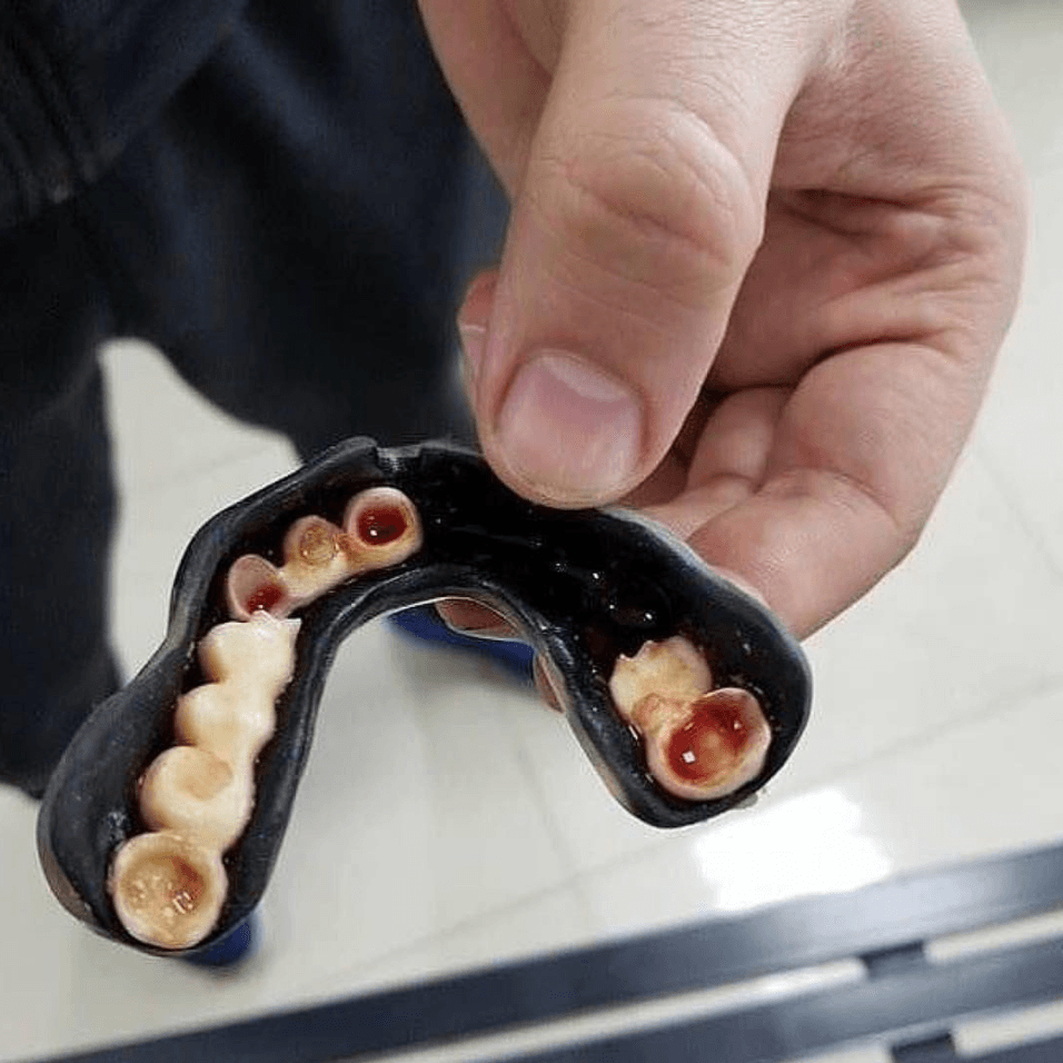 Hand holding a tooth-designed mouthguard