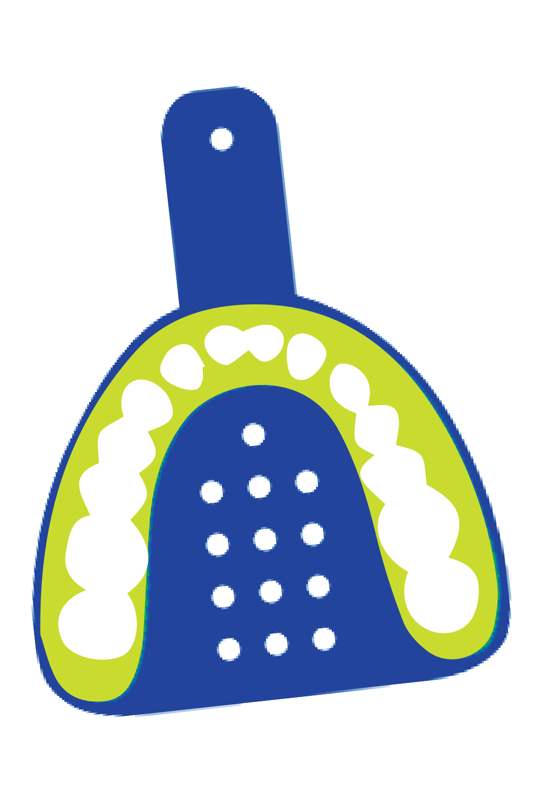 Illustration of a dental impression tray