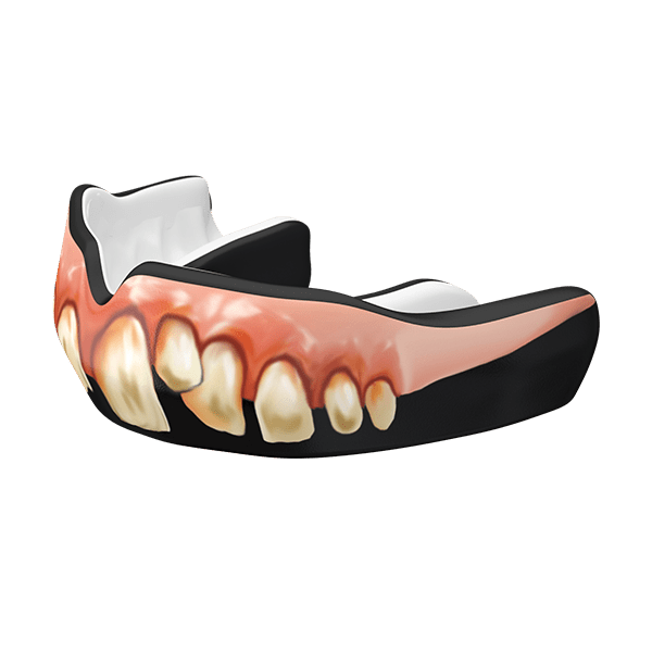 Bubba Guard Custom Fit - Damage Control Mouthguards