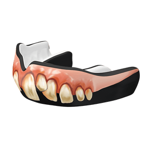 Damage Control Mouthguard-Bubba Guard Custom Fit