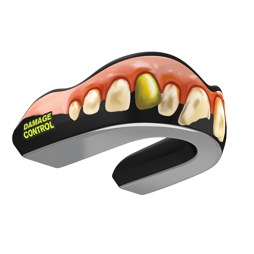 Bubba Guard (EI) - Damage Control Mouthguards