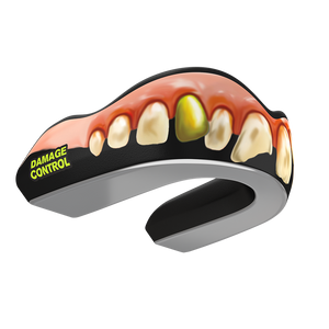 Damage Control Mouthguards-Bubba Guard