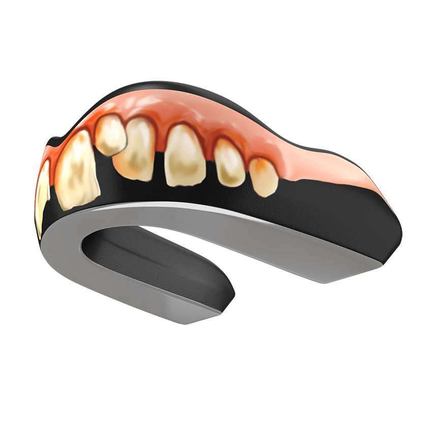 Bubba Guard (EI) - Damage Control Mouthguards