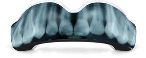 X-Ray Mouthguard (EI) - Damage Control Mouthguards