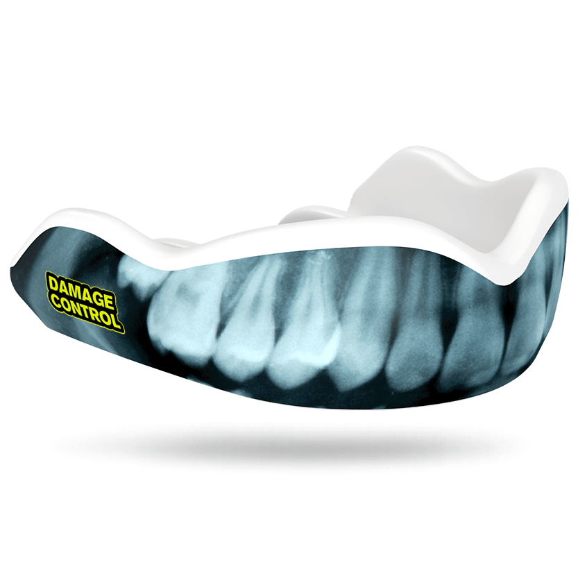 X-Ray Mouthguard (HI) - Damage Control Mouthguards