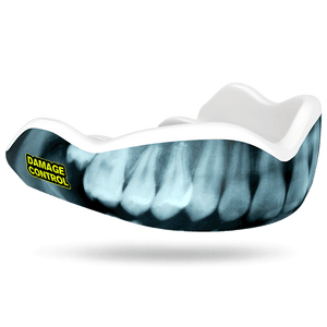 X-Ray Mouthguard (HI) - Damage Control Mouthguards