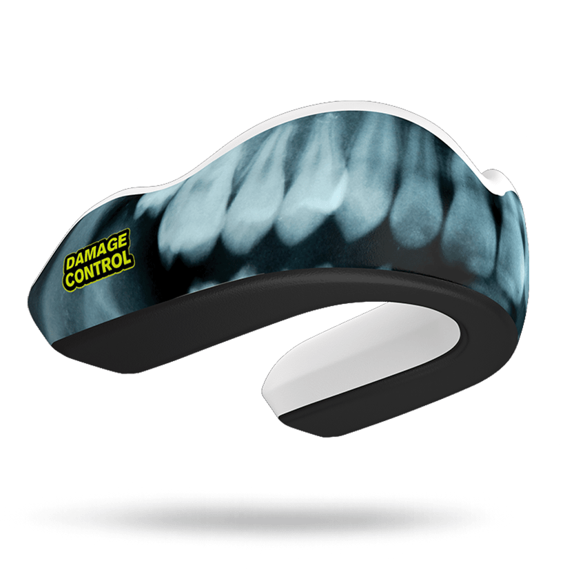 X-Ray Mouthguard (EI) - Damage Control Mouthguards
