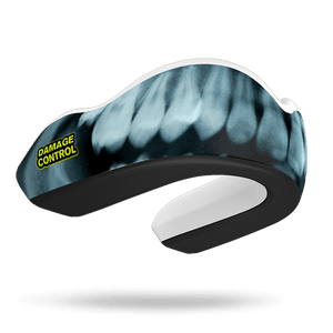 X-Ray Mouthguard (EI) - Damage Control Mouthguards