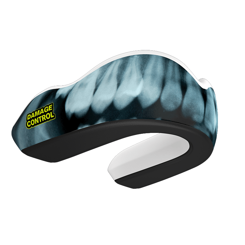 X-Ray Mouthguard (EI) - Damage Control Mouthguards