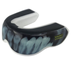 X-Ray Mouthguard (EI) - Damage Control Mouthguards