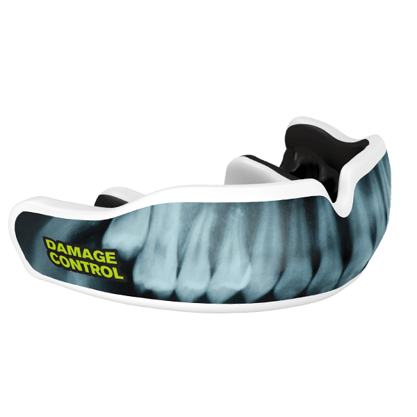 X-Ray Custom Mouthguard Damage Control Mouthguards