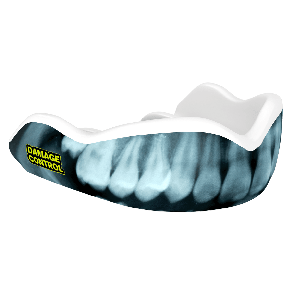 X-Ray Mouthguard (HI) - Damage Control Mouthguards